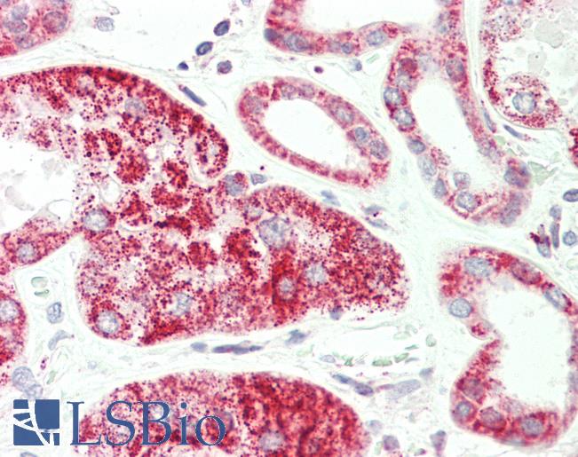 HADH Antibody - Human, Kidney: Formalin-Fixed Paraffin-Embedded (FFPE).  This image was taken for the unconjugated form of this product. Other forms have not been tested.