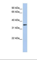 HADH Antibody - Fetal heart lysate. Antibody concentration: 1.0 ug/ml. Gel concentration: 12%.  This image was taken for the unconjugated form of this product. Other forms have not been tested.