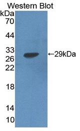 HADH Antibody - Western Blot; Sample: Recombinant protein.