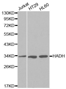 HADH Antibody - Western blot analysis of extracts of various cell lines.