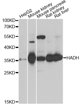 HADH Antibody - Western blot analysis of extracts of various cell lines, using HADH antibody at 1:1000 dilution. The secondary antibody used was an HRP Goat Anti-Rabbit IgG (H+L) at 1:10000 dilution. Lysates were loaded 25ug per lane and 3% nonfat dry milk in TBST was used for blocking. An ECL Kit was used for detection and the exposure time was 5s.