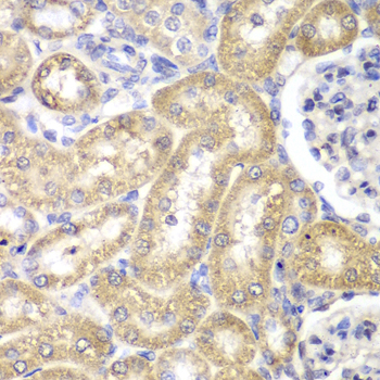 HADH Antibody - Immunohistochemistry of paraffin-embedded rat liver using HADH antibodyat dilution of 1:100 (40x lens).