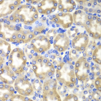 HADH Antibody - Immunohistochemistry of paraffin-embedded mouse liver using HADH antibodyat dilution of 1:100 (40x lens).