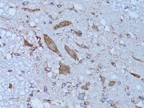 HADH Antibody - Immunohistochemistry of paraffin-embedded rat spinal cord using HADH antibodyat dilution of 1:100 (40x lens).