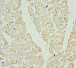 HADH Antibody - Immunohistochemistry of paraffin-embedded human heart tissue at dilution 1:100