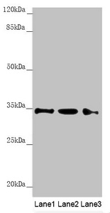 HADH Antibody - Western blot All Lanes: HADH antibody at 1.21 ug/ml Lane 1: Mouse heart tissue Lane 2: Mouse liver tissue Lane 3: Mouse kidney tissue Secondary Goat polyclonal to rabbit IgG at 1/10000 dilution Predicted band size: 35,43,37 kDa Observed band size: 34 kDa