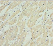 HADH Antibody - Immunohistochemistry of paraffin-embedded human heart tissue at dilution 1:100