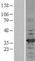 HADH Protein - Western validation with an anti-DDK antibody * L: Control HEK293 lysate R: Over-expression lysate