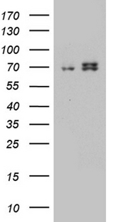 HADHA Antibody - HEK293T cells were transfected with the pCMV6-ENTRY control. (Left lane) or pCMV6-ENTRY HADHA. (Right lane) cDNA for 48 hrs and lysed
