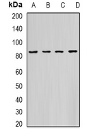 HADHA Antibody - Western blot analysis of HADHA expression in K562 (A); PC3 (B); HeLa (C); mouse heart (D) whole cell lysates.