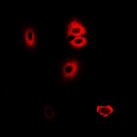 HADHA Antibody - Immunofluorescent analysis of HADHA staining in U2OS cells. Formalin-fixed cells were permeabilized with 0.1% Triton X-100 in TBS for 5-10 minutes and blocked with 3% BSA-PBS for 30 minutes at room temperature. Cells were probed with the primary antibody in 3% BSA-PBS and incubated overnight at 4 deg C in a humidified chamber. Cells were washed with PBST and incubated with a DyLight 594-conjugated secondary antibody (red) in PBS at room temperature in the dark.