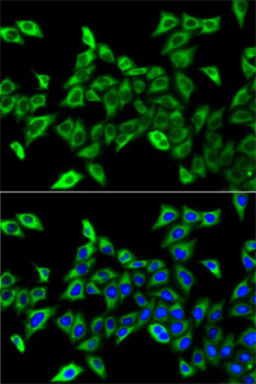HADHA Antibody - Immunofluorescence analysis of A-549 cells using HADHA antibody. Blue: DAPI for nuclear staining.
