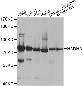 HADHA Antibody - Western blot analysis of extracts of various cell lines, using HADHA antibody at 1:1000 dilution. The secondary antibody used was an HRP Goat Anti-Rabbit IgG (H+L) at 1:10000 dilution. Lysates were loaded 25ug per lane and 3% nonfat dry milk in TBST was used for blocking.