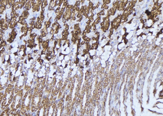 HADHA Antibody - 1:100 staining human gastric tissue by IHC-P. The sample was formaldehyde fixed and a heat mediated antigen retrieval step in citrate buffer was performed. The sample was then blocked and incubated with the antibody for 1.5 hours at 22°C. An HRP conjugated goat anti-rabbit antibody was used as the secondary.