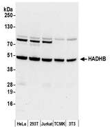 HADHB Antibody - Detection of human and mouse HADHB by western blot. Samples: Whole cell lysate (50 µg) from HeLa, HEK293T, Jurkat, mouse TCMK-1, and mouse NIH 3T3 cells prepared using NETN lysis buffer. Antibody: Affinity purified rabbit anti-HADHB antibody used for WB at 0.1 µg/ml. Detection: Chemiluminescence with an exposure time of 10 seconds.