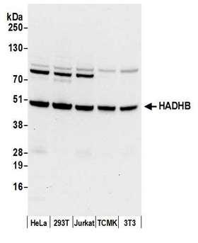 HADHB Antibody - Detection of human and mouse HADHB by western blot. Samples: Whole cell lysate (50 µg) from HeLa, HEK293T, Jurkat, mouse TCMK-1, and mouse NIH 3T3 cells prepared using NETN lysis buffer. Antibody: Affinity purified rabbit anti-HADHB antibody used for WB at 0.1 µg/ml. Detection: Chemiluminescence with an exposure time of 10 seconds.