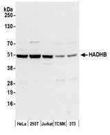 HADHB Antibody - Detection of human and mouse HADHB by western blot. Samples: Whole cell lysate (50 µg) from HeLa, HEK293T, Jurkat, mouse TCMK-1, and mouse NIH 3T3 cells prepared using NETN lysis buffer. Antibody: Affinity purified rabbit anti-HADHB antibody used for WB at 0.1 µg/ml. Detection: Chemiluminescence with an exposure time of 10 seconds.