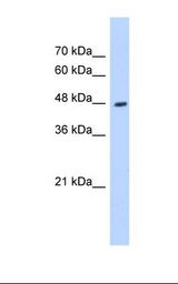 HADHB Antibody - HepG2 cell lysate. Antibody concentration: 0.25 ug/ml. Gel concentration: 12%.  This image was taken for the unconjugated form of this product. Other forms have not been tested.