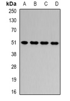 HADHB Antibody - Western blot analysis of HADHB expression in HepG2 (A); Jurkat (B); mouse liver (C); rat liver (D) whole cell lysates.
