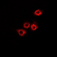 HADHB Antibody - Immunofluorescent analysis of HADHB staining in A549 cells. Formalin-fixed cells were permeabilized with 0.1% Triton X-100 in TBS for 5-10 minutes and blocked with 3% BSA-PBS for 30 minutes at room temperature. Cells were probed with the primary antibody in 3% BSA-PBS and incubated overnight at 4 deg C in a humidified chamber. Cells were washed with PBST and incubated with a DyLight 594-conjugated secondary antibody (red) in PBS at room temperature in the dark.