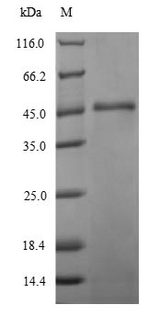 eaeA Protein - (Tris-Glycine gel) Discontinuous SDS-PAGE (reduced) with 5% enrichment gel and 15% separation gel.