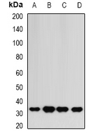 HAGH Antibody - Western blot analysis of HAGH expression in HepG2 (A); mouse liver (B); mouse heart (C); rat kidney (D) whole cell lysates.