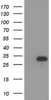 HAGHL Antibody - HEK293T cells were transfected with the pCMV6-ENTRY control (Left lane) or pCMV6-ENTRY HAGHL (Right lane) cDNA for 48 hrs and lysed. Equivalent amounts of cell lysates (5 ug per lane) were separated by SDS-PAGE and immunoblotted with anti-HAGHL.