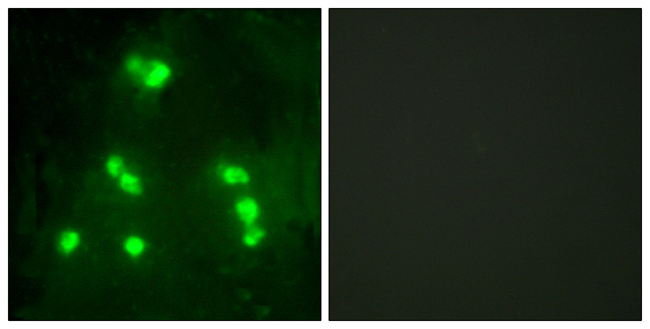 Hairless / HR Antibody - Immunofluorescence analysis of A549 cells, using HAIR Antibody. The picture on the right is blocked with the synthesized peptide.