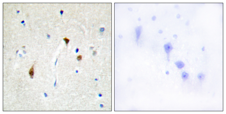 Hairless / HR Antibody - Immunohistochemistry analysis of paraffin-embedded human brain tissue, using HAIR Antibody. The picture on the right is blocked with the synthesized peptide.