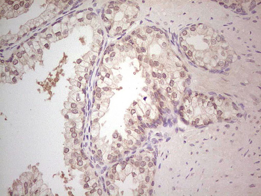 Hairless / HR Antibody - Immunohistochemical staining of paraffin-embedded Human prostate tissue within the normal limits using anti-HR mouse monoclonal antibody. (Heat-induced epitope retrieval by Tris-EDTA, pH8.0) Dilution: 1:150