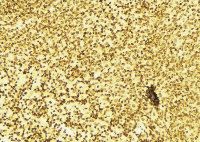 Hairless / HR Antibody - 1:100 staining mouse spleen tissue by IHC-P. The sample was formaldehyde fixed and a heat mediated antigen retrieval step in citrate buffer was performed. The sample was then blocked and incubated with the antibody for 1.5 hours at 22°C. An HRP conjugated goat anti-rabbit antibody was used as the secondary.