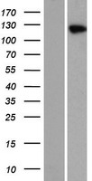 Hairless / HR Protein - Western validation with an anti-DDK antibody * L: Control HEK293 lysate R: Over-expression lysate