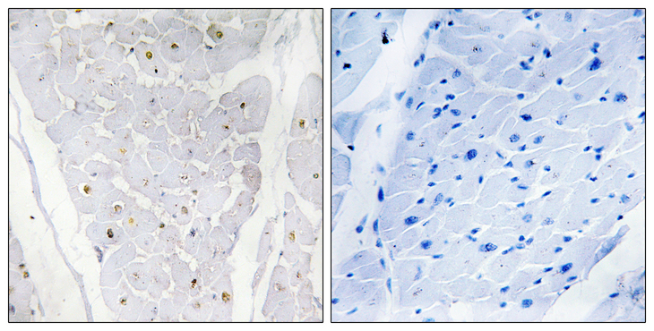 HAK / ALPK2 Antibody - Immunohistochemistry analysis of paraffin-embedded human heart , using ALPK2 Antibody. The picture on the right is blocked with the synthesized peptide.