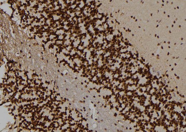 HAK / ALPK2 Antibody - 1:100 staining rat brain tissue by IHC-P. The sample was formaldehyde fixed and a heat mediated antigen retrieval step in citrate buffer was performed. The sample was then blocked and incubated with the antibody for 1.5 hours at 22°C. An HRP conjugated goat anti-rabbit antibody was used as the secondary.
