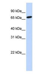 HAL / Histidine Ammonium Lyase Antibody - HAL / Histidine Ammonium Lyase antibody Western Blot of 721_B cell lysate.  This image was taken for the unconjugated form of this product. Other forms have not been tested.