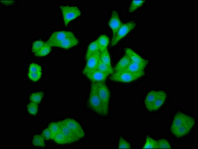 HAL / Histidine Ammonium Lyase Antibody - Immunofluorescence staining of HepG2 cells at a dilution of 1:66, counter-stained with DAPI. The cells were fixed in 4% formaldehyde, permeabilized using 0.2% Triton X-100 and blocked in 10% normal Goat Serum. The cells were then incubated with the antibody overnight at 4 °C.The secondary antibody was Alexa Fluor 488-congugated AffiniPure Goat Anti-Rabbit IgG (H+L) .