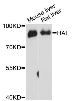 HAL / Histidine Ammonium Lyase Antibody - Western blot analysis of extracts of various cell lines, using HAL antibody at 1:3000 dilution. The secondary antibody used was an HRP Goat Anti-Rabbit IgG (H+L) at 1:10000 dilution. Lysates were loaded 25ug per lane and 3% nonfat dry milk in TBST was used for blocking. An ECL Kit was used for detection and the exposure time was 90s.