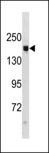 Hamartin / TSC1 Antibody - Mouse TSC1 Antibody (C-term S1138) western blot of mouse liver tissue lysates (35 ug/lane). The Mouse TSC1 antibody detected the Mouse TSC1 protein (arrow).