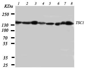 Hamartin / TSC1 Antibody - WB of Hamartin / TSC1 antibody. Lane 1: Rat Skeletal Muscle Tissue Lysate. Lane 2: Rat Heart Tissue Lysate. Lane 3: Rat Brain Tissue Lysate. Lane 4: Rat Lung Tissue Lysate. Lane 5: 293t Cell Lysate. Lane 6: HELA Cell Lysate. Lane 7: HT1080 Cell Lysate. Lane 8: SMMC Cell Lysate. Lane 9: PANV Cell Lysate..