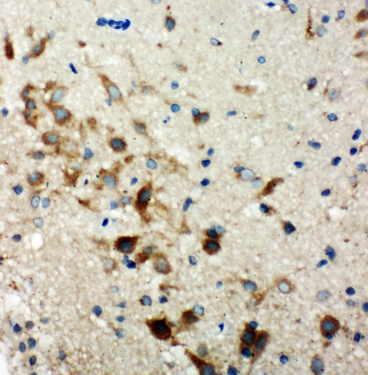 Hamartin / TSC1 Antibody - Hamartin / TSC1 antibody. IHC(P): Rat Brain Tissue.