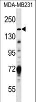 Hamartin / TSC1 Antibody - TSC1 Antibody western blot of MDA-MB231 cell line lysates (35 ug/lane). The TSC1 antibody detected the TSC1 protein (arrow).