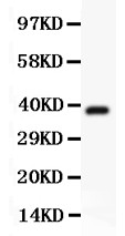 Hamartin / TSC1 Antibody - Hamartin antibody Western blot. All lanes: Anti Hamartin at 0.5 ug/ml. WB: Recombinant Human Hamartin Protein 0.5ng. Predicted band size: 38 kD. Observed band size: 38 kD.