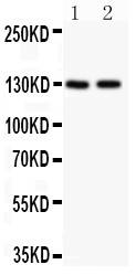 Hamartin / TSC1 Antibody - Hamartin antibody Western blot. All lanes: Anti Hamartin at 0.5 ug/ml. Lane 1: Rat Brain Tissue Lysate at 50 ug . Lane 2: HeLa Whole Cell Lysate at 40 ug. Predicted band size: 130 kD. Observed band size: 130 kD.
