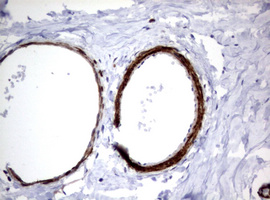 Hamartin / TSC1 Antibody - IHC of paraffin-embedded Human breast tissue using anti-TSC1 mouse monoclonal antibody.