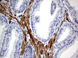 Hamartin / TSC1 Antibody - IHC of paraffin-embedded Human prostate tissue using anti-TSC1 mouse monoclonal antibody.