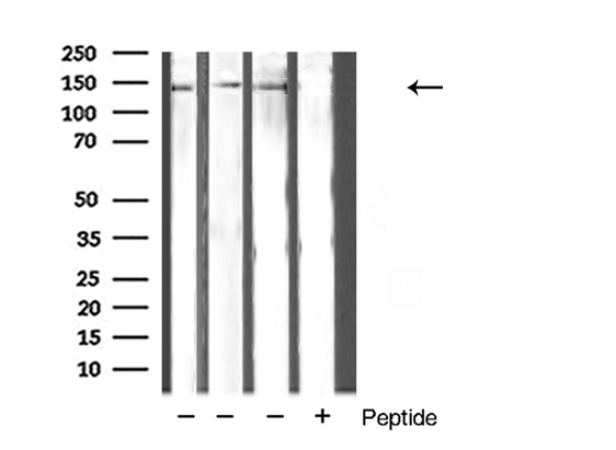 Hamartin / TSC1 Antibody - Western blot analysis of TSC1 expression in various cells lysate