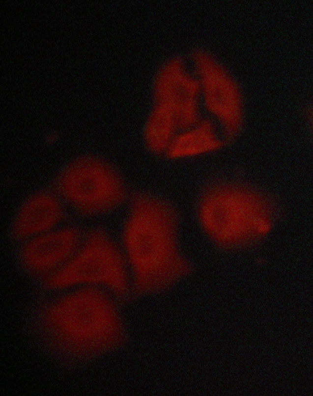 Hamartin / TSC1 Antibody - Staining MCF-7 cells by IF/ICC. The samples were fixed with PFA and permeabilized in 0.1% saponin prior to blocking in 10% serum for 45 min at 37°C. The primary antibody was diluted 1/400 and incubated with the sample for 1 hour at 37°C. A Alexa Fluor® 594 conjugated goat polyclonal to rabbit IgG (H+L), diluted 1/600 was used as secondary antibody.