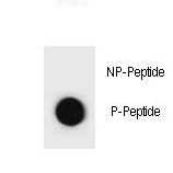 Hamartin / TSC1 Antibody - Dot blot of TSC1 Antibody (Phospho S1080) Phospho-specific antibody on nitrocellulose membrane. 50ng of Phospho-peptide or Non Phospho-peptide per dot were adsorbed. Antibody working concentrations are 0.6ug per ml.