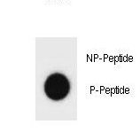 Hamartin / TSC1 Antibody - Dot blot of mouse TSC1 Antibody (Phospho S387) Phospho-specific antibody on nitrocellulose membrane. 50ng of Phospho-peptide or Non Phospho-peptide per dot were adsorbed. Antibody working concentrations are 0.6ug per ml.