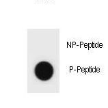Hamartin / TSC1 Antibody - Dot blot of TSC1 Antibody (Phospho S511) Phospho-specific antibody on nitrocellulose membrane. 50ng of Phospho-peptide or Non Phospho-peptide per dot were adsorbed. Antibody working concentrations are 0.6ug per ml.